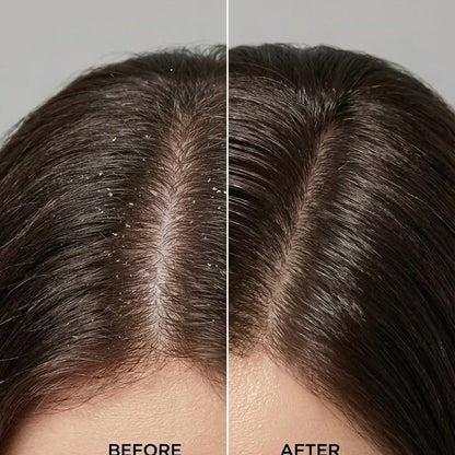 Milk Protein Repair Shampoo For Hair Growth